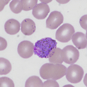 Case335_G.jpg Figure G