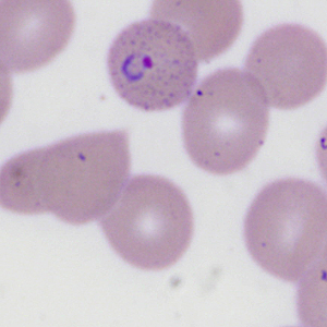 Case335_H.jpg Figure H