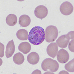 Case335_I.jpg Figure I