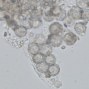 The DPDx Team received a worm-like object collected from a child's diaper for diagnostic assistance. Grossly, the object was white, semi-flattened, and measured approximately 4.0 mm long by 2.0 mm wide.