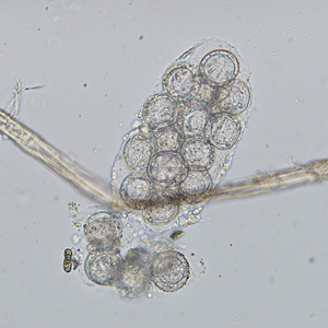 Case336_B.jpg Figure B