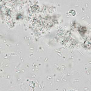 A five-year-old boy developed loose, watery stools approximately one week after attending a birthday party for a friend. 