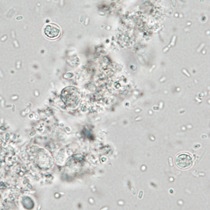 Case337_B.jpg Figure B