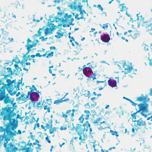 Case337_C.jpg Figure C