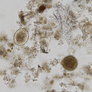 A 42-year-old pig farmer presented to his local medical facility with intermittent diarrhea and abdominal cramping. 