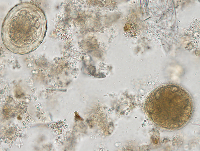 Case338_B.jpg Figure B