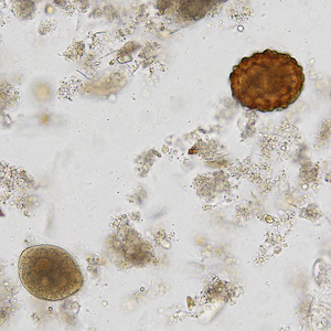 Case338_C.jpg Figure C