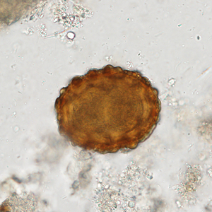 Case338_D.jpg Figure D