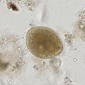 Case338_E.jpg Figure E