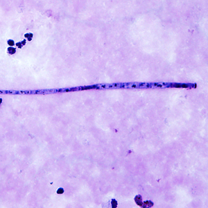 Case339_B.jpg Figure B