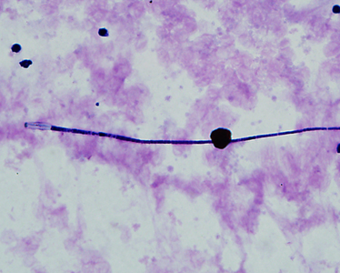 Case339_C.jpg Figure C