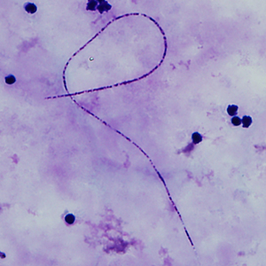 Case339_D.jpg Figure C