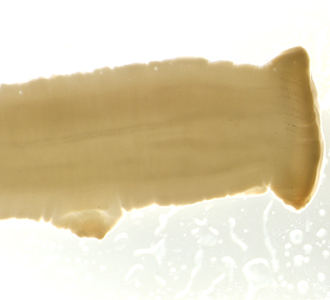 Case340_B.jpg Figure B