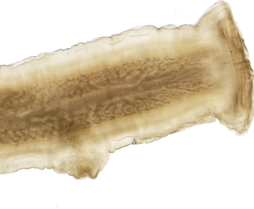 Case340_D.jpg Figure D