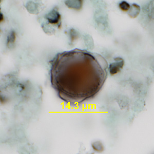 Case341_A.jpg Figure A