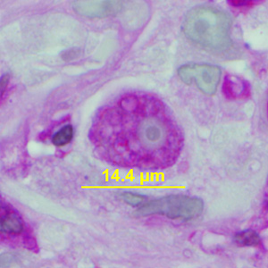 Case341_B.jpg Figure B