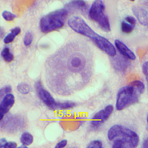 Case341_C.jpg Figure C