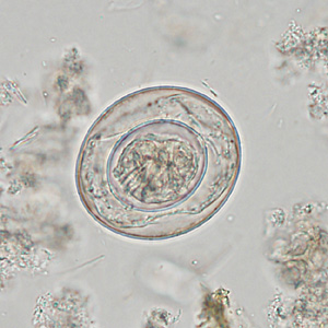 A 24-year-old man sought medical attention from his health care provider for intermittent abdominal cramping and mild diarrhea. A stool specimen was collected in 10% formalin for laboratory testing. 