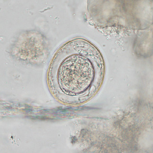 Case342_B.jpg Figure B