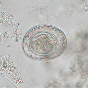 Case342_C.jpg Figure C