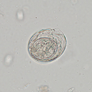 Case342_D.jpg Figure D