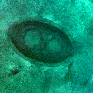 Case343_B.jpg Figure B