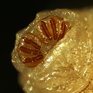 Case344_B.jpg Figure B