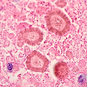 Case345_B.jpg Figure B