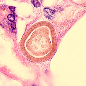 Case345_C.jpg Figure C
