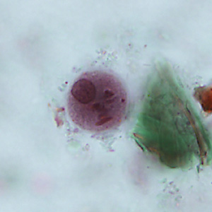 Case346_B.jpg Figure B