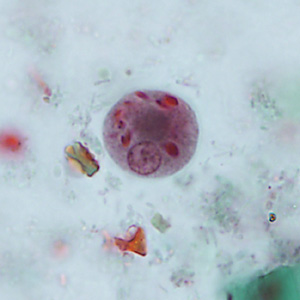 Case346_C.jpg Figure C