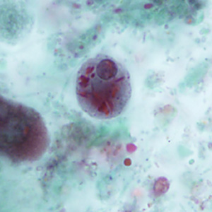 Case346_D.jpg Figure D