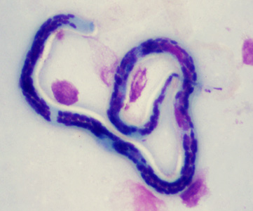 Case347_B.jpg Figure B