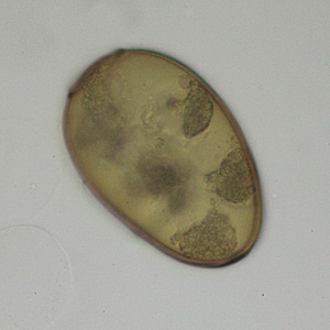 A 24-year-old refugee from Thailand was being treated for tuberculosis by a local health department. Sputum specimens were collected at regular intervals to monitor the treatment progress. 