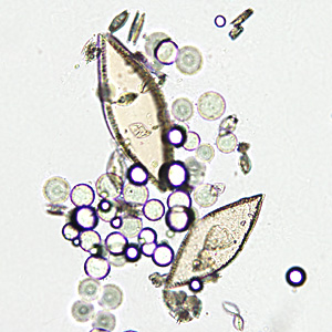 Case349_B.jpg Figure B