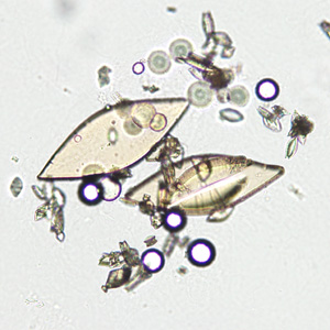 Case349_C.jpg Figure C