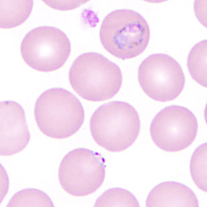 Case350_B.jpg Figure B