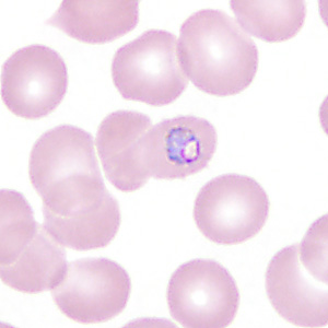 Case350_D.jpg Figure D