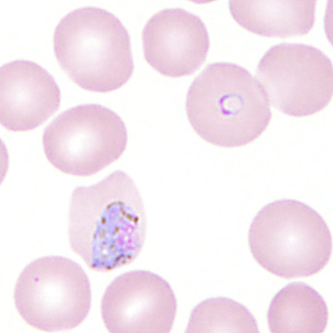 Case350_E.jpg Figure E