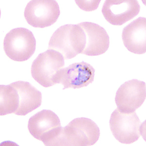 Case350_F.jpg Figure F