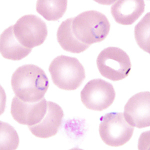 Case350_H.jpg Figure H