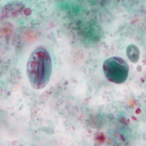 Case351_B.jpg Figure B