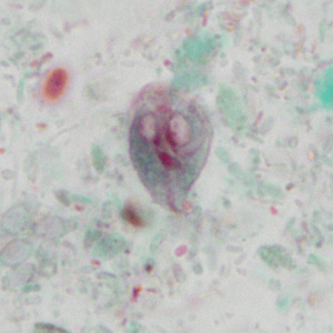 Case351_C.jpg Figure C