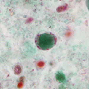 Case351_D.jpg Figure D