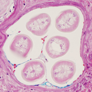 Case352_B.jpg Figure B