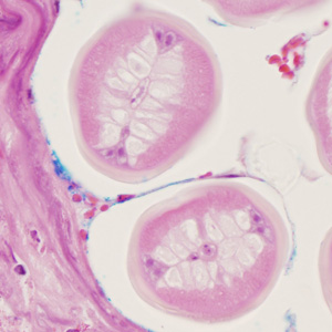 Case352_C.jpg Figure C
