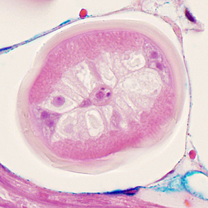 Case352_D.jpg Figure D