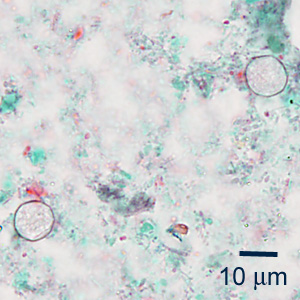 Case353_B.jpg Figure B