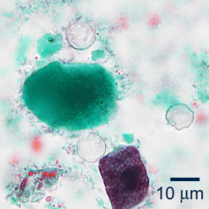 Case353_C.jpg Figure C