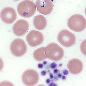 Case354_B.jpg Figure B